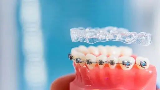 newdent