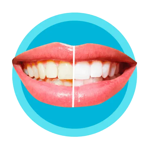 newdent